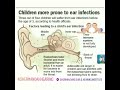 Children ear infections