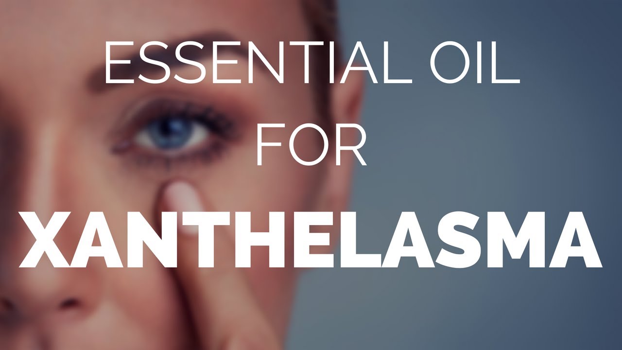 Essential oil for xanthelasma, will it work? Lets find out. YouTube