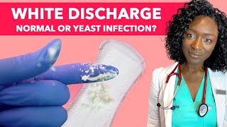 vaginal yeast infection discharge