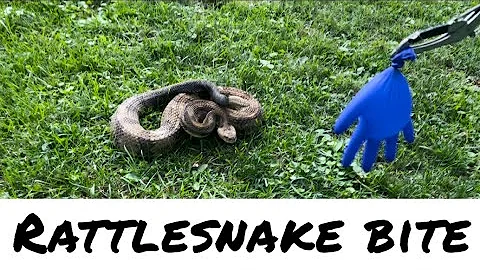 Rattlesnake Bite - Slow Motion Footage