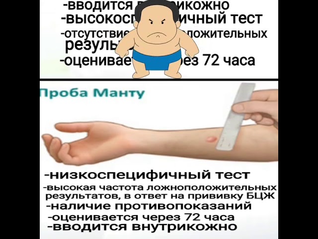 Реакция манту