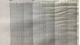 ELE112 Ch 19 Filters Band pass Bode Plot Part 2