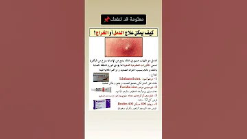 كيف تعالج الدمل أو الخراج Science معلومات صحة 