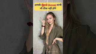 Your acne will never clear |मुंहासे, acne scar, Pimples, काले दाग-धब्बे, shorts acne skincare yt