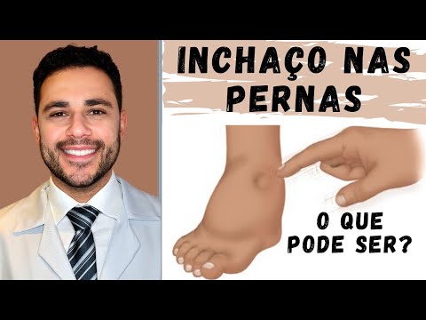 Inchaço nas pernas? Saiba o que pode ser - Cardiologista - Dr. Caio Henrique