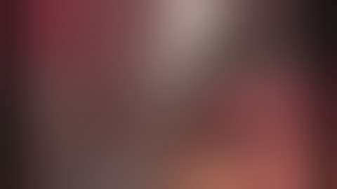 Laparoscopic Resection of HCC in Seg VI by Dr Hossam Soliman M.D.