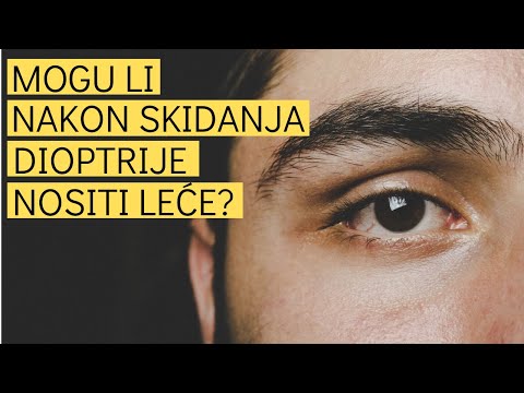 Mogu li nakon skidanja dioptrije ponovo nositi leće? | Optical Express Hrvatska