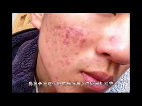 不同部位长痘，不同器脏问题！这次全齐了，建议收藏