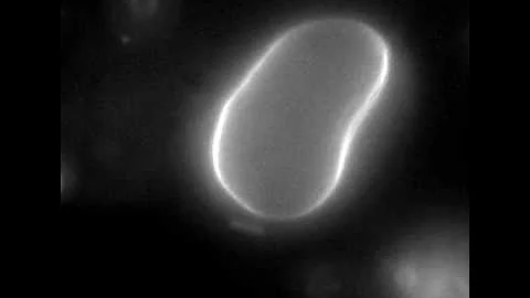 Phase Transition Driven Morphological Changes