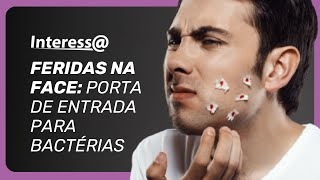Não cutuca a pele! Celulite facial é mais comum do que parece | Interessa Podcast