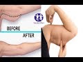 HOW TO TIGHTEN AND TONE SAGGING ARMS | THIS WILL GET RID OF SAGGING ARM FASTER,Effective secret rec