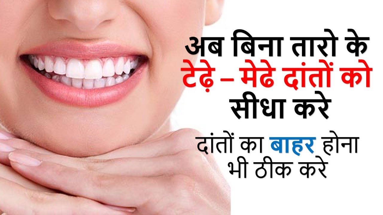 अब बिना तारो के टेढ़े मेढे दांतों को सीधा करे Crooked Teeth Tips