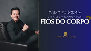 Como funciona o transplante capilar com FIOS DO CORPO?