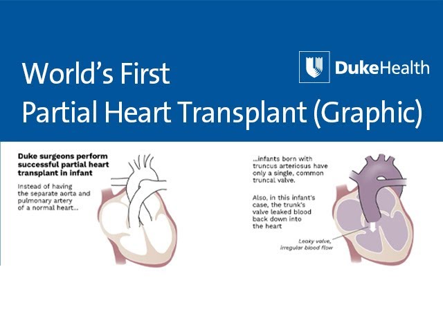 Animation Graphic - World's First Partial Heart Transplant | Duke Health -  YouTube