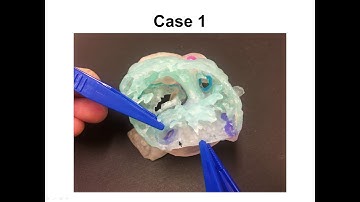 Utilization of 3D printed heart model