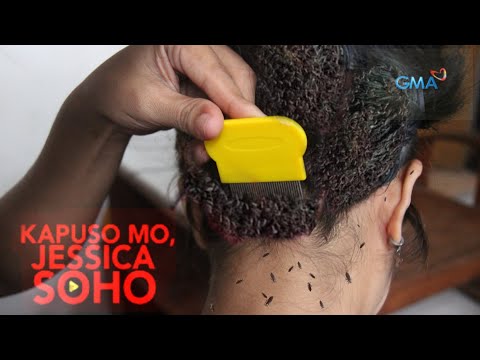 Video: Sino ang may pinakamaraming DNA?