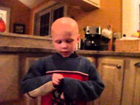 Alopecia through the eyes of a 6 year old