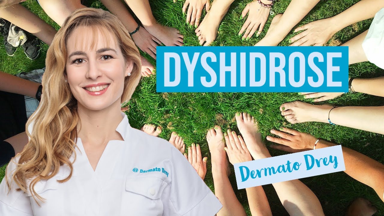 La dyshidrose : des cloques qui grattent sur les mains et pieds...  #DermatoDrey