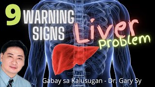 9 Warning Signs of Liver Problem  Dr. Gary Sy