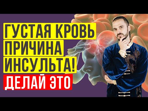 Как разжижать густую кровь без лекарств! #Shorts