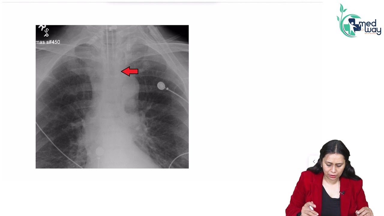 Advanced Airway || Anaesthesia || By Dr. Swati Singh 🔥🔥 #anesthisa #medway