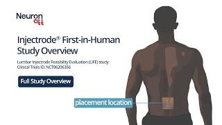 Injectrode LIFE Study Overview: Full Overview
