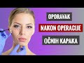 Oporavak nakon operacije kapaka dr nedeljkovi i dr stojievi