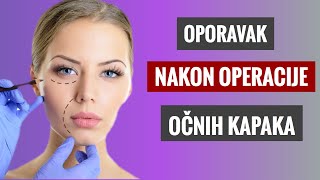 Oporavak nakon operacije kapaka, dr Nedeljković i dr Stojićević