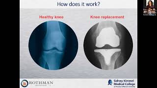 Home Sweet Home: Outpatient Hip and Knee Replacement – A Lecture from Dr. Saxena screenshot 5