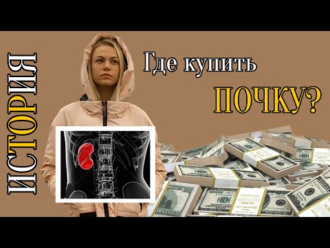 Где купить почку? #история девушки рожденной с Одной почкой