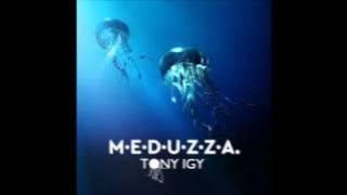 Tony Igy - M.E.D.U.Z.Z.A
