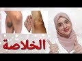 تفتيح وتقشير الركب و الأكواع في ٣ أيام فقط بأقل التكاليف والتخلص من الإسمرار والسواد نهائيا تفتيح وتقشير الركب و الأكواع في ٣ أيام فقط بأقل التكاليف والتخلص من الإسمرار والسواد نهائيا