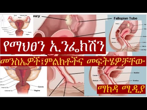 ቪዲዮ: መከላከያዎች ከተከፈቱ በኋላ ማቀዝቀዝ አለባቸው?