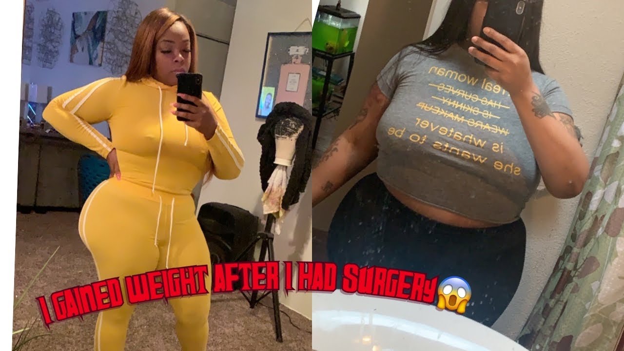 Gaining weight after surgery 😱 YouTube