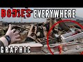 FOUND HUMAN REMAINS EVERYWHERE MASS GRAVES WARNING GRAPHIC 
