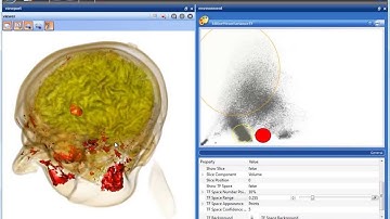 Volume Visualization based on Statistical Transfer-Function Spaces