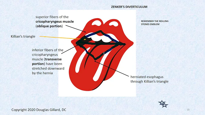 GI-GU: (Wk4)(Thur)(Win2...  Zenker's Diverticulum, Zollinger-Elliso...  syndrome, Vitamin B12 Absorption