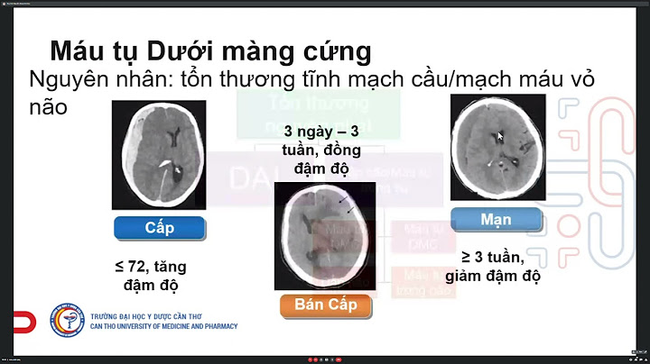 Cách xử lý khi bị chấn thương sọ não