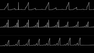 KenoTron - "Nightly Delirium (ZXS 128k)" [Oscilloscope View] screenshot 2