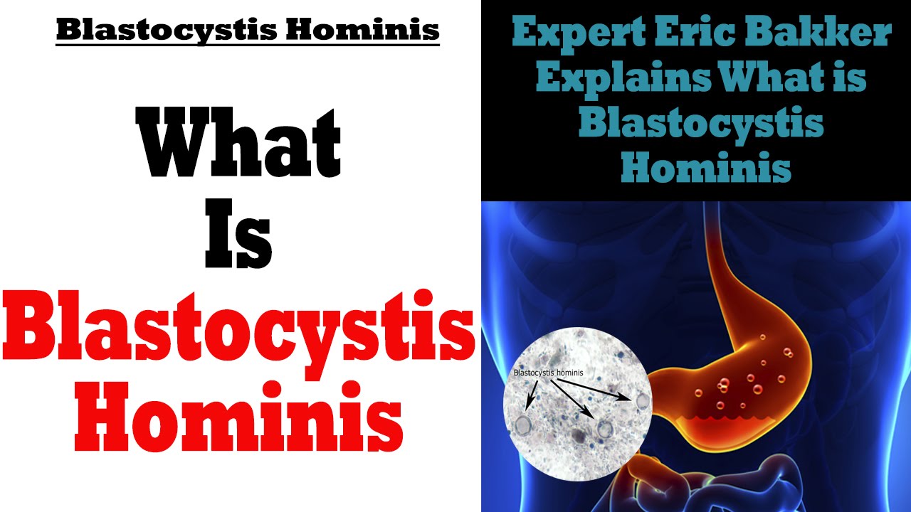 blastocystis hominis bél paraziták