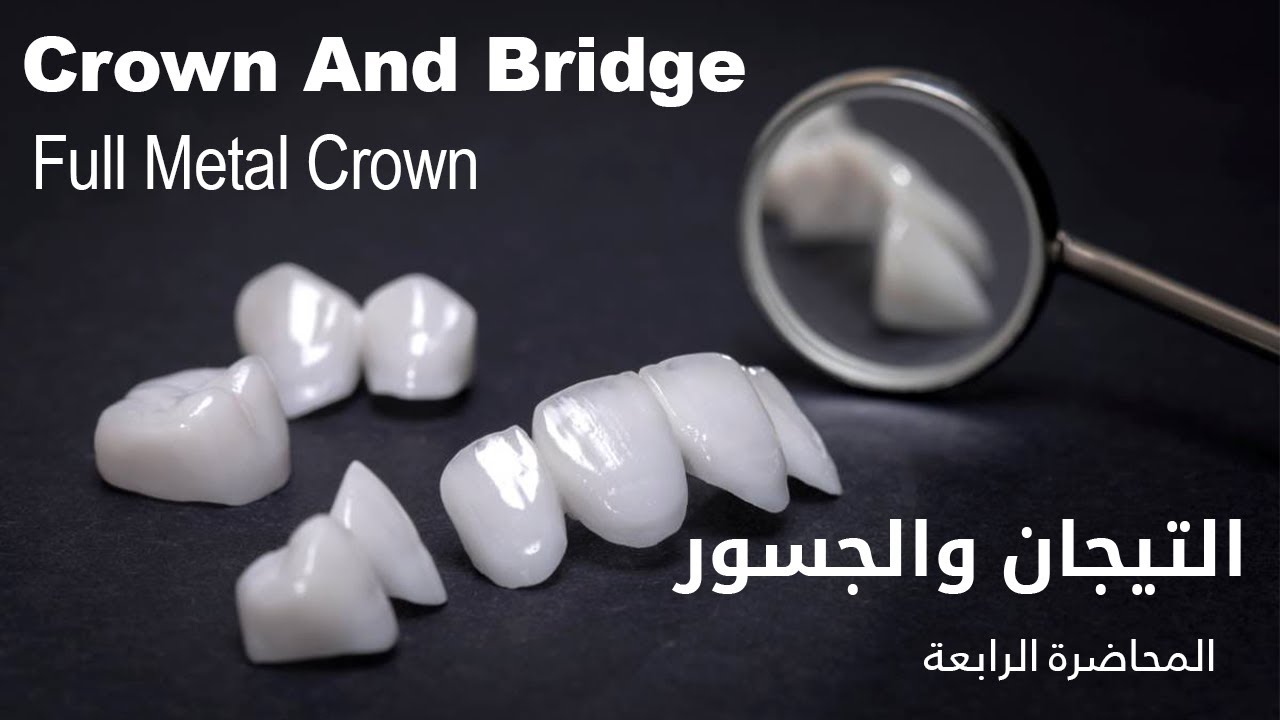 الجسور والتيجان المحاضرة الرابعة - Crown & Bridge Full Metal Crown
