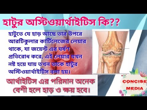 ভিডিও: হাঁটু প্রাচীর মানে কি?