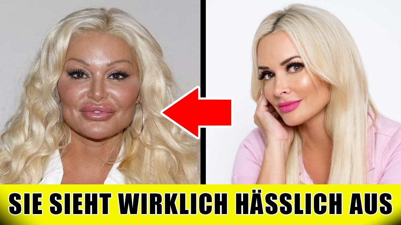 12 schöne deutsche Stars, deren Gesichter durch Schönheits-OPs drastisch verändert wurden