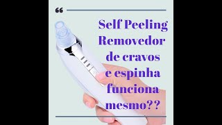 Self  peeling removedor de cravos e espinhas funciona mesmo?