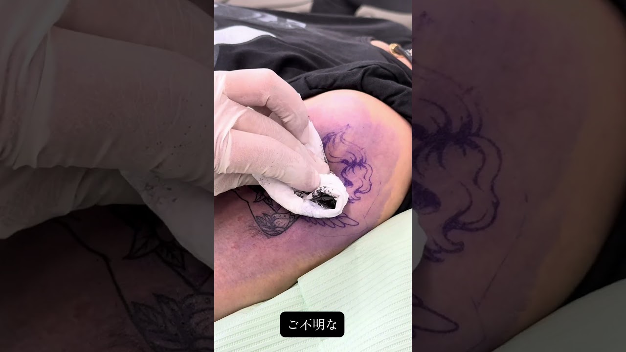カップルで施術🫶🏻