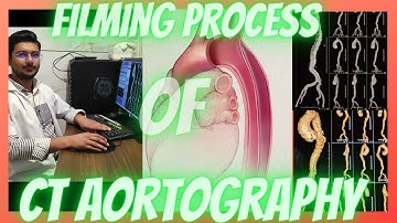 How to make Films of CT Scan Aortography/ Aortogram/ Aortic Angiography #radiologytechnologist