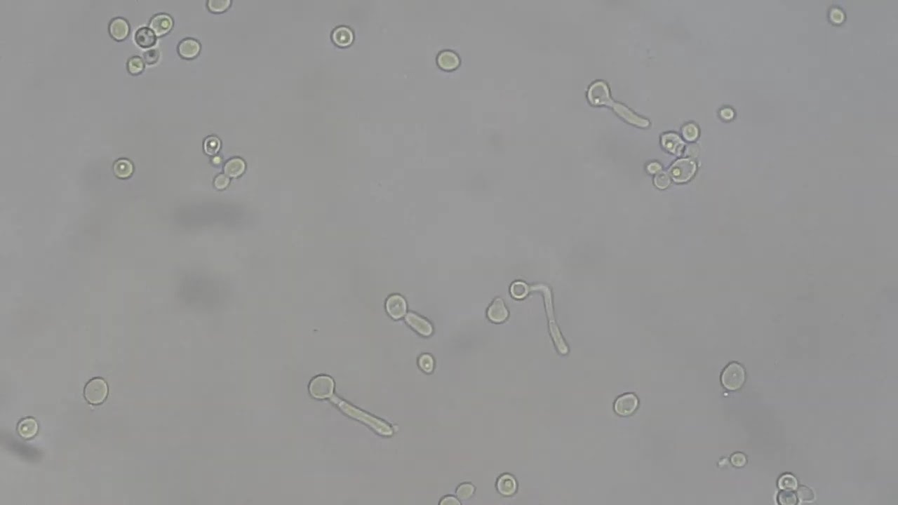 Germ tube test positive of Candida albicans