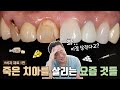 아직도 치과가 무서우신가요? 최신 치과 이렇게 발전했습니다!( ※ 15분 만에 뚝딱 만드는 치과 로봇 대공개 ※ )