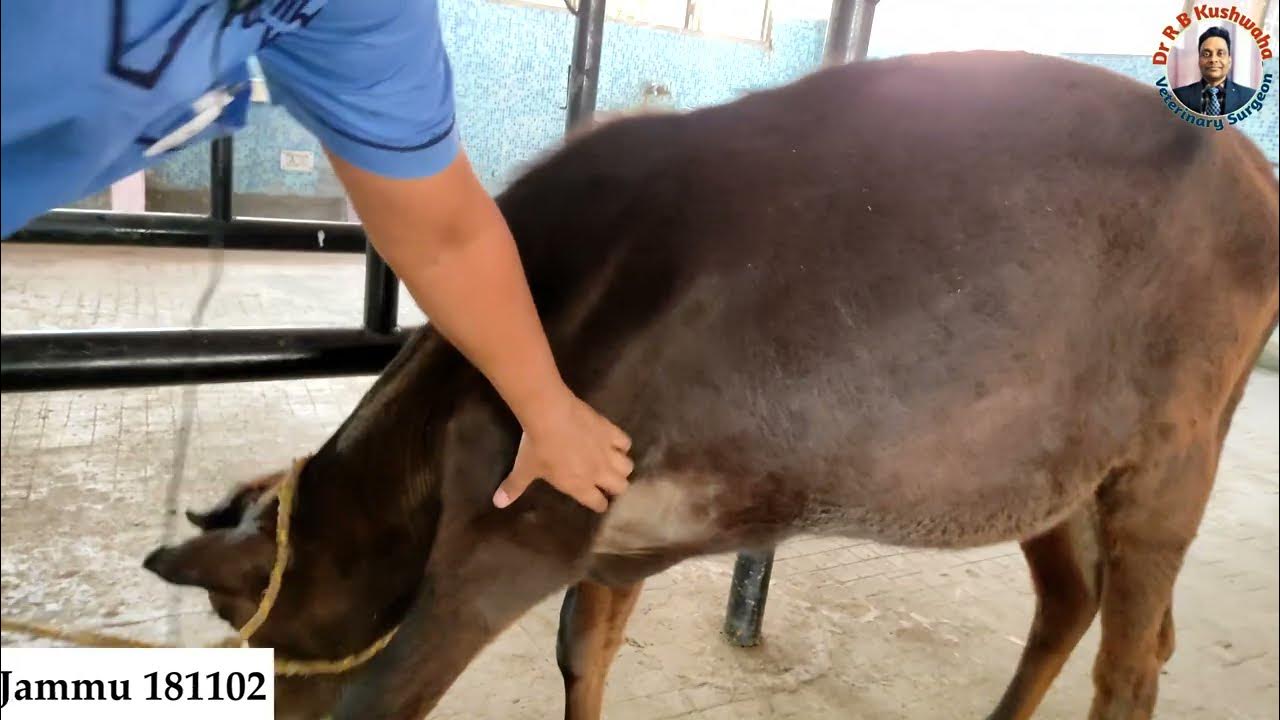 Radial nerve paralysis secondary to distal 1/3rd diaphyseal fracture of