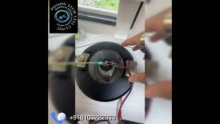 Green Plasma During TPE? Liver Damage & Anti-Ageing Explained | Dr Abhinit Gupta